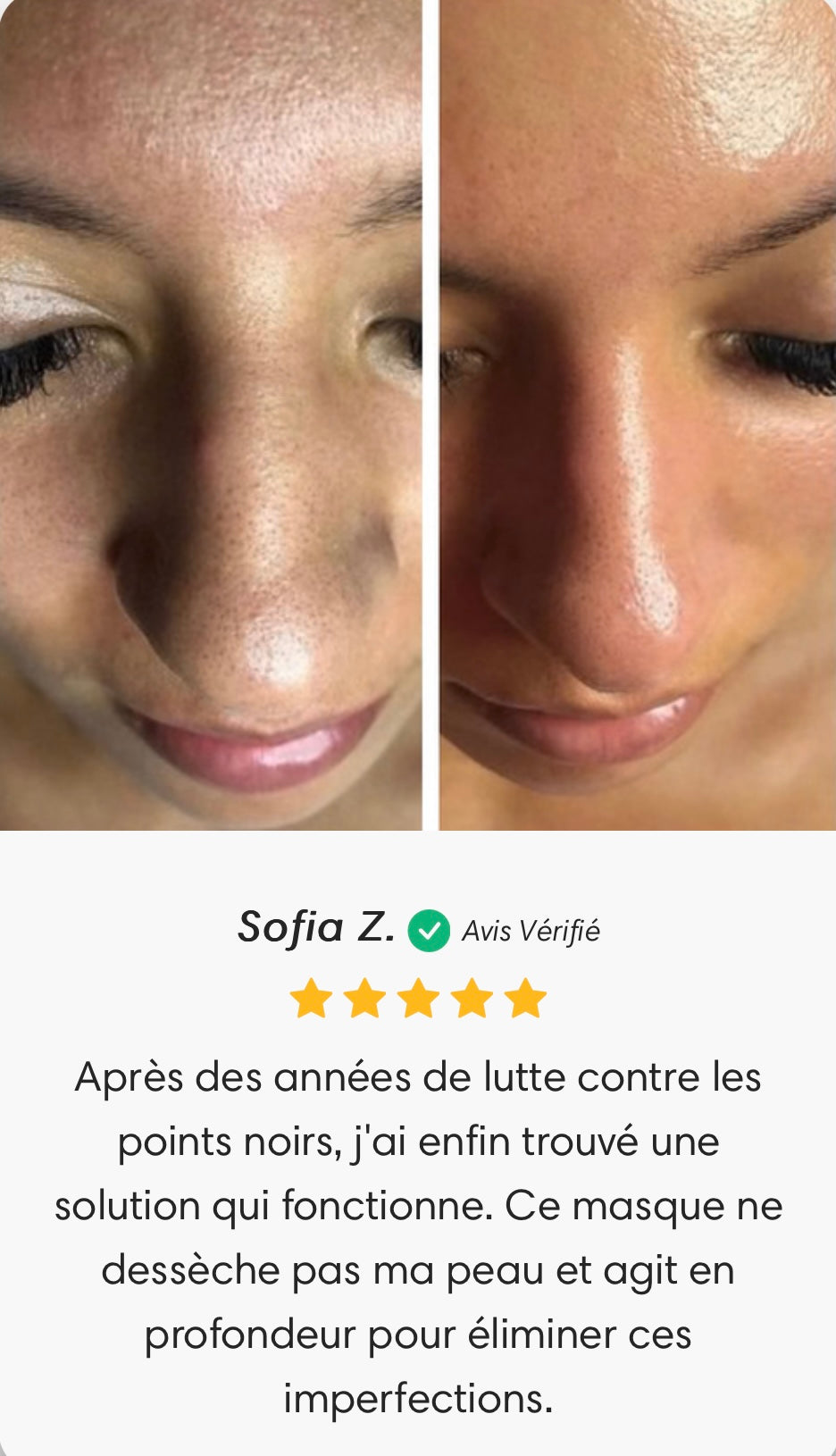 Hail Lanbena Nasal Mask &amp; Anti-acne Peeling Serum 