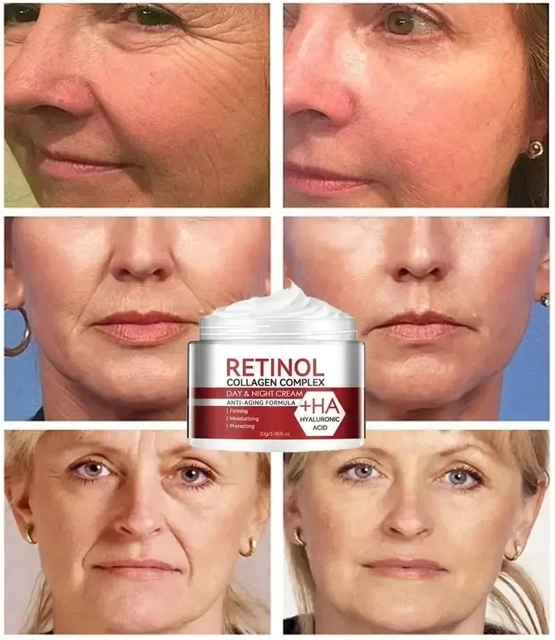 1a- Crème collagène Retinol hydratante, 50 ml pour femme