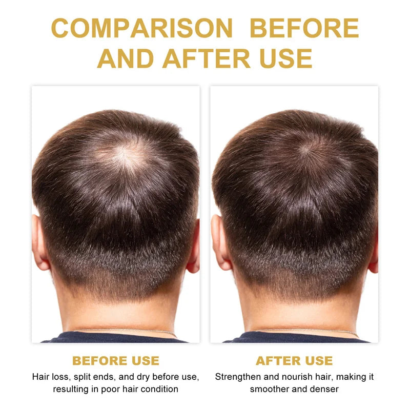 c-2  Gamme de cheveux,  pousse plus eelhoe romarin, masque, shampooing, conditioner, sérum.